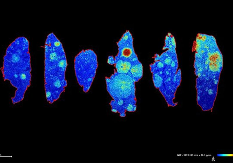 Los investigadores descubren que el glucógeno y los glicanos unidos a N se acumulan en las regiones fibróticas del pulmón y pueden ser importantes para el desarrollo de terapias.