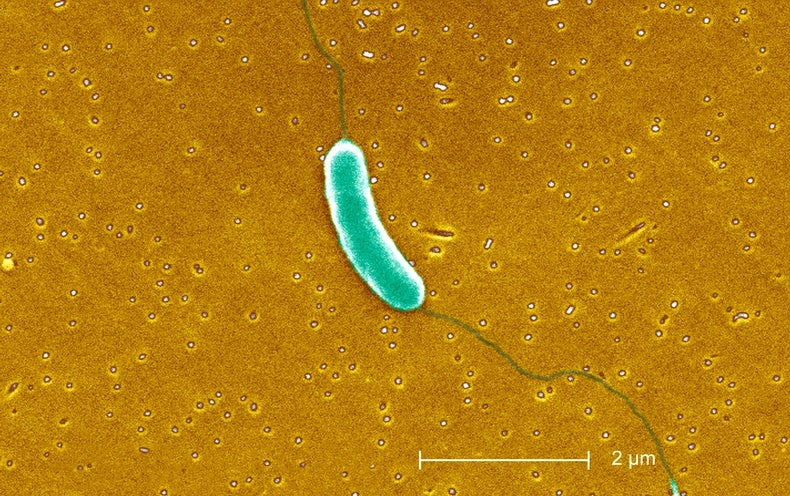 Las infecciones por bacterias carnívoras están aumentando en los EE. UU. Aquí le mostramos cómo mantenerse a salvo