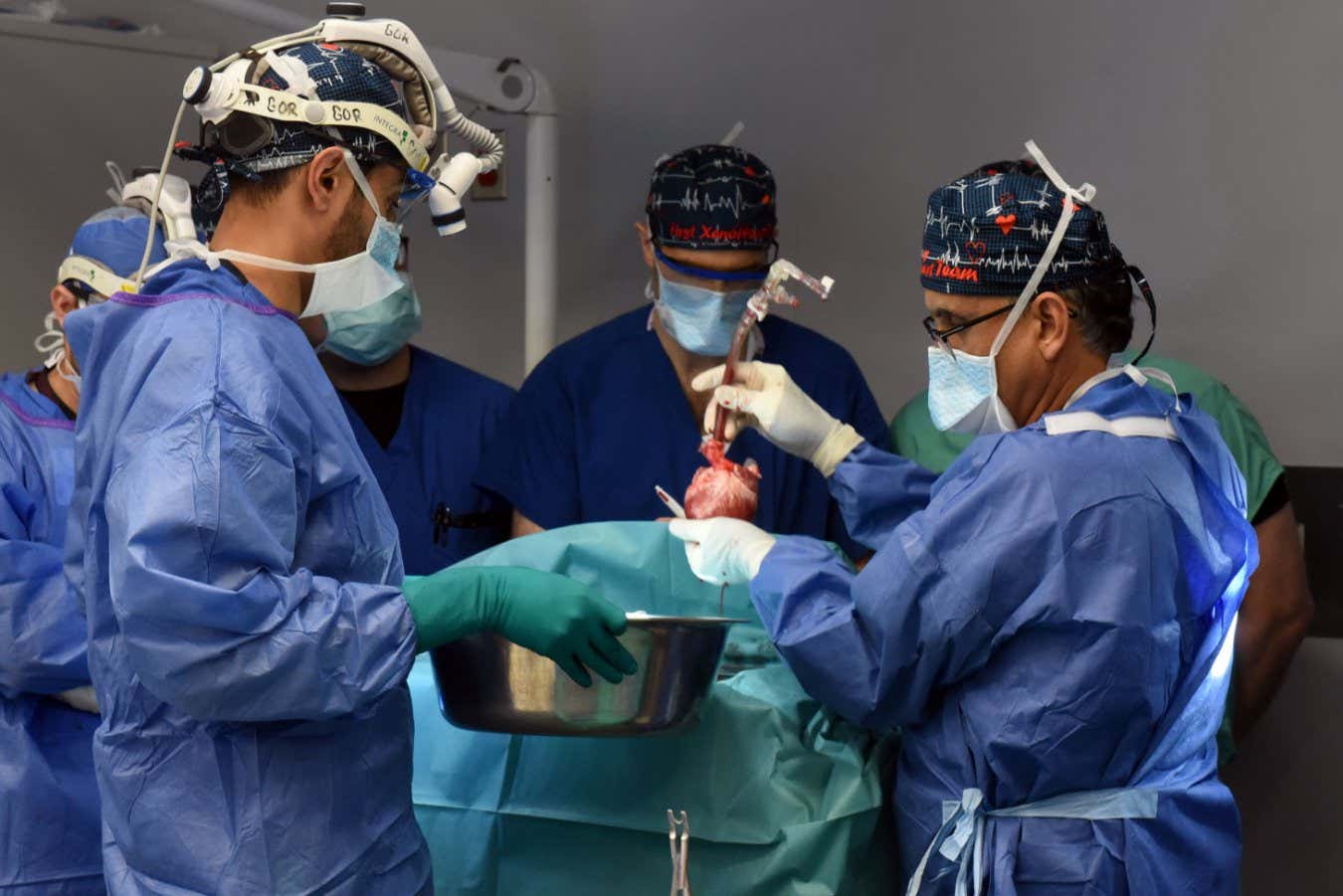 Xenotrasplante: los cirujanos realizan el segundo trasplante de corazón de cerdo a humano