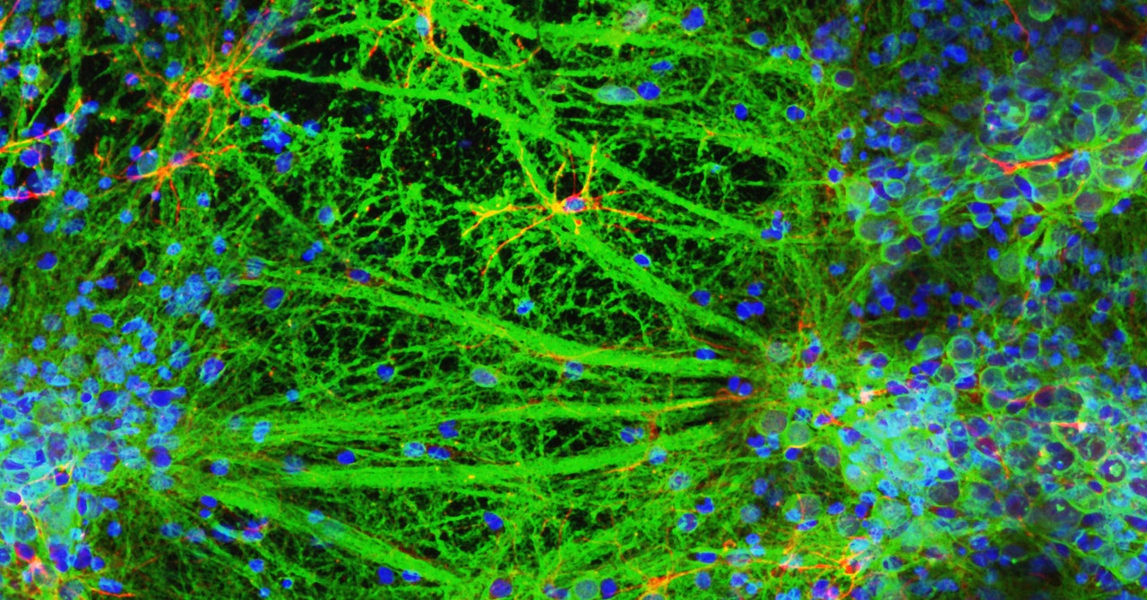 Un laboratorio acaba de imprimir en 3D una red neuronal de células cerebrales vivas
