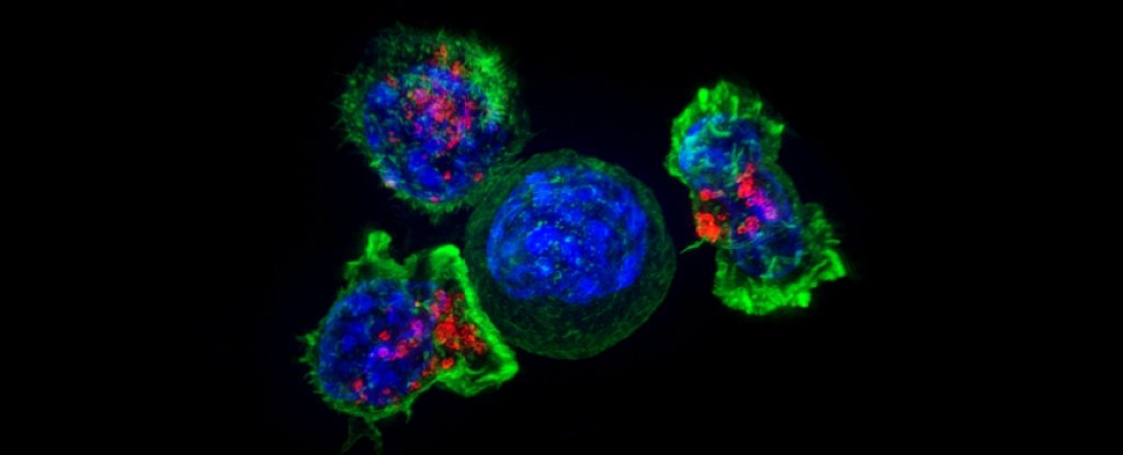 El primer estudio mundial encuentra que las células inmunitarias son cruciales para detener el cáncer de intestino: ScienceAlert