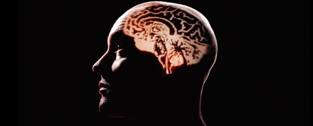 Los científicos advierten sobre un sesgo extremo en la investigación sobre el envejecimiento cerebral: ScienceAlert