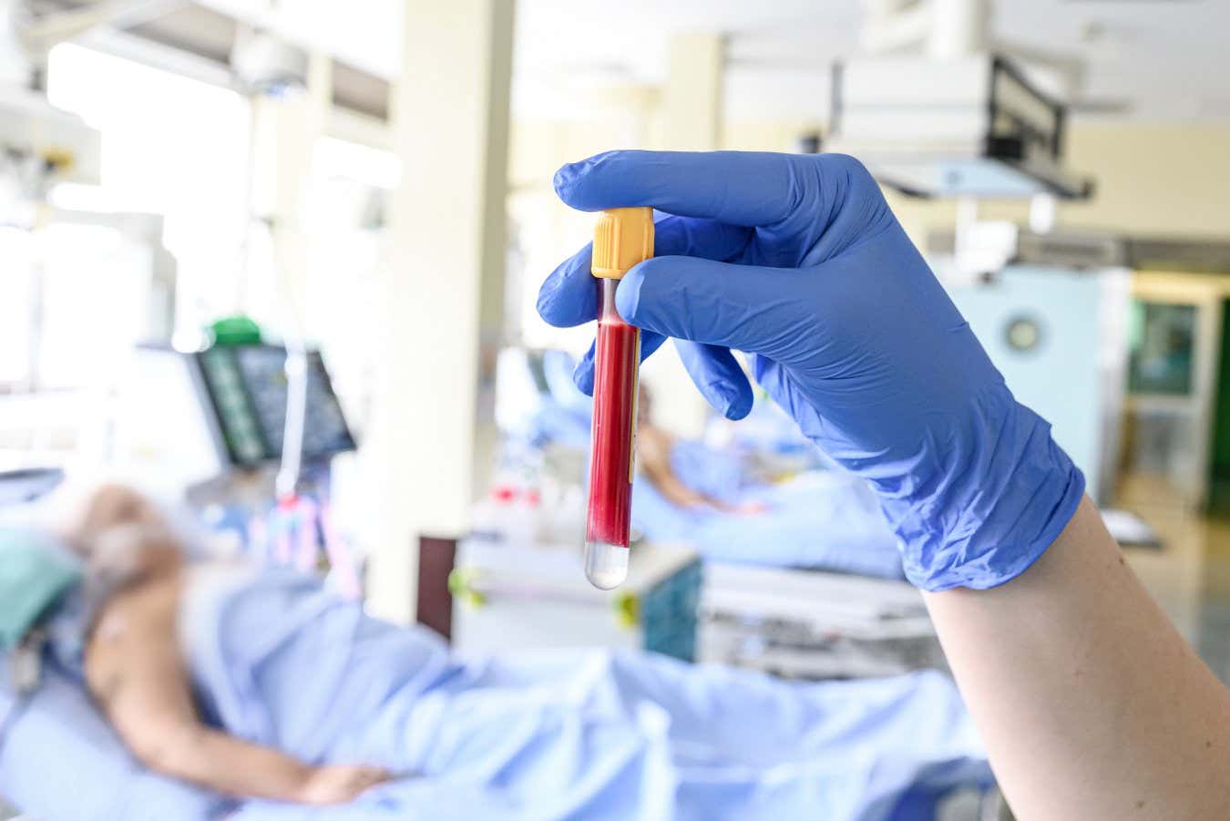 Un simple ajuste en los análisis de sangre podría hacer que el tratamiento en cuidados intensivos sea más seguro