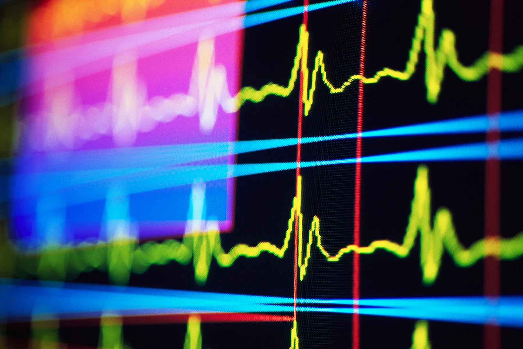 Flexibilidad en el lugar de trabajo Menor riesgo de enfermedad cardiovascular