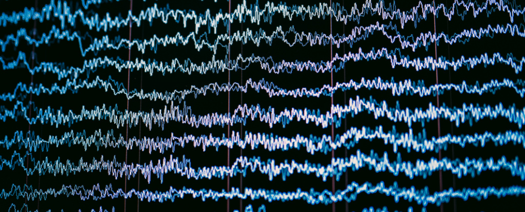 El ruido de fondo del cerebro podría explicar el éxito de la terapia electroconvulsiva: ScienceAlert
