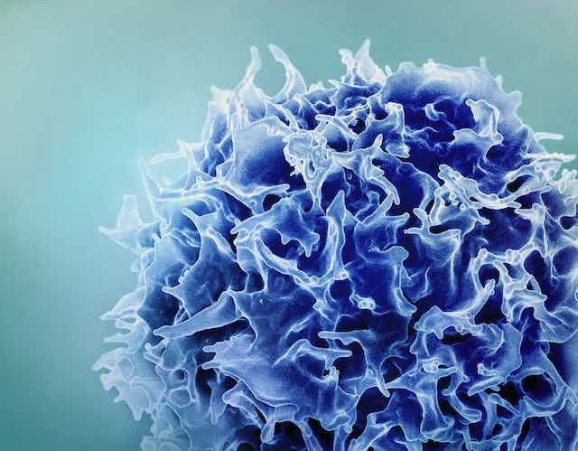 La salud inmunitaria tiene que ver con el equilibrio: un inmunólogo explica por qué una respuesta inmunitaria demasiado fuerte y demasiado débil puede provocar enfermedades