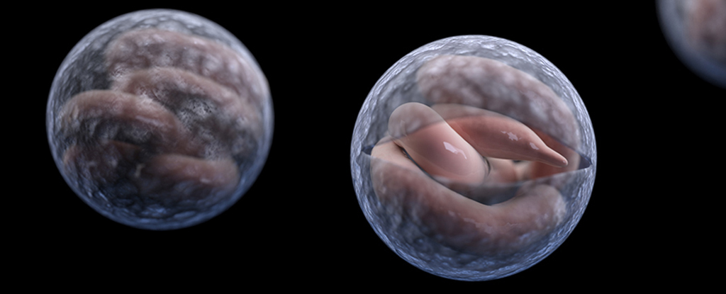 Los casos de diarrea grave aumentan en todo el Reino Unido y los científicos no saben por qué: ScienceAlert