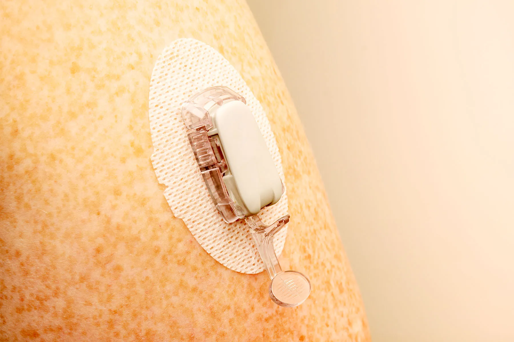¿Son una buena idea los monitores de glucosa para personas sin diabetes?