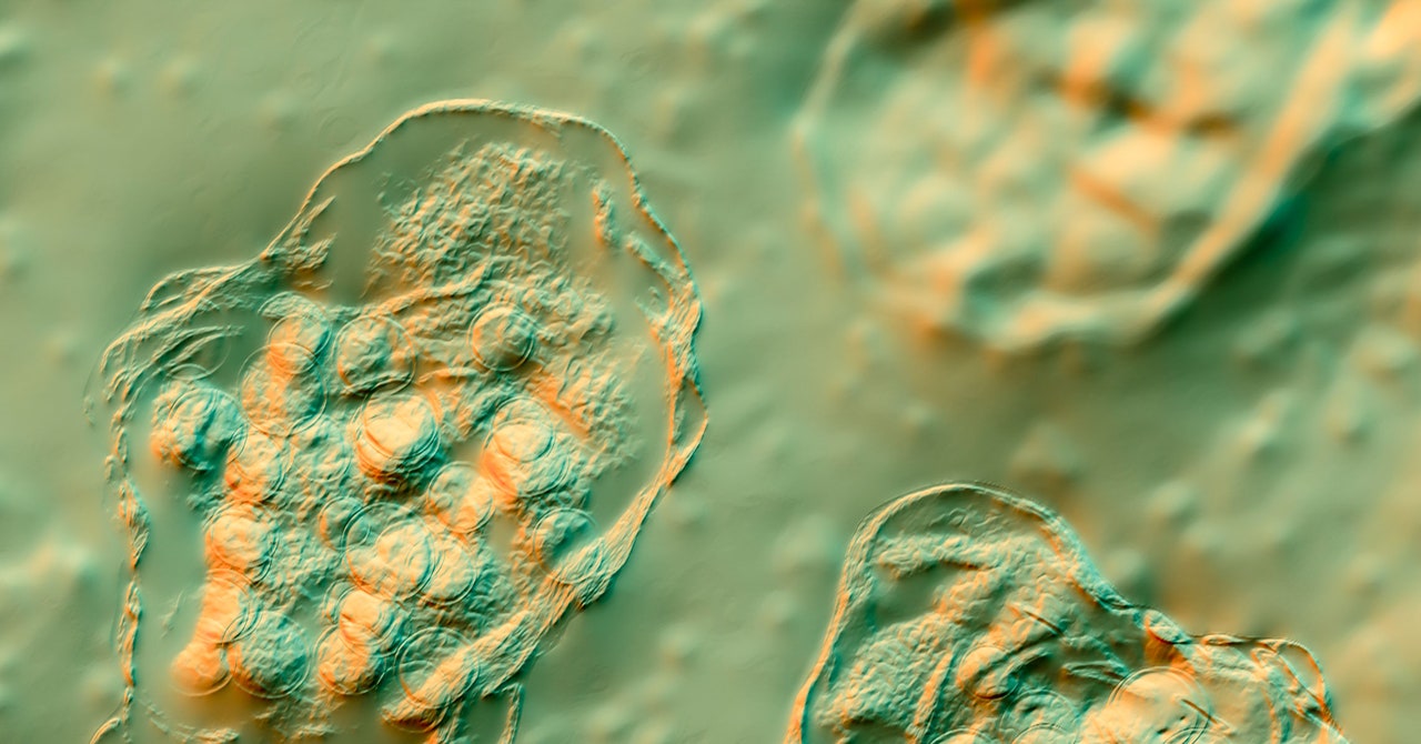 El sarampión ataca una escuela primaria de Florida con más de 100 niños no vacunados