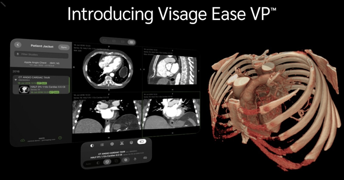 Visage Imaging Introducing Visage Ease Vp For Apple Vision Pro 1.jpg
