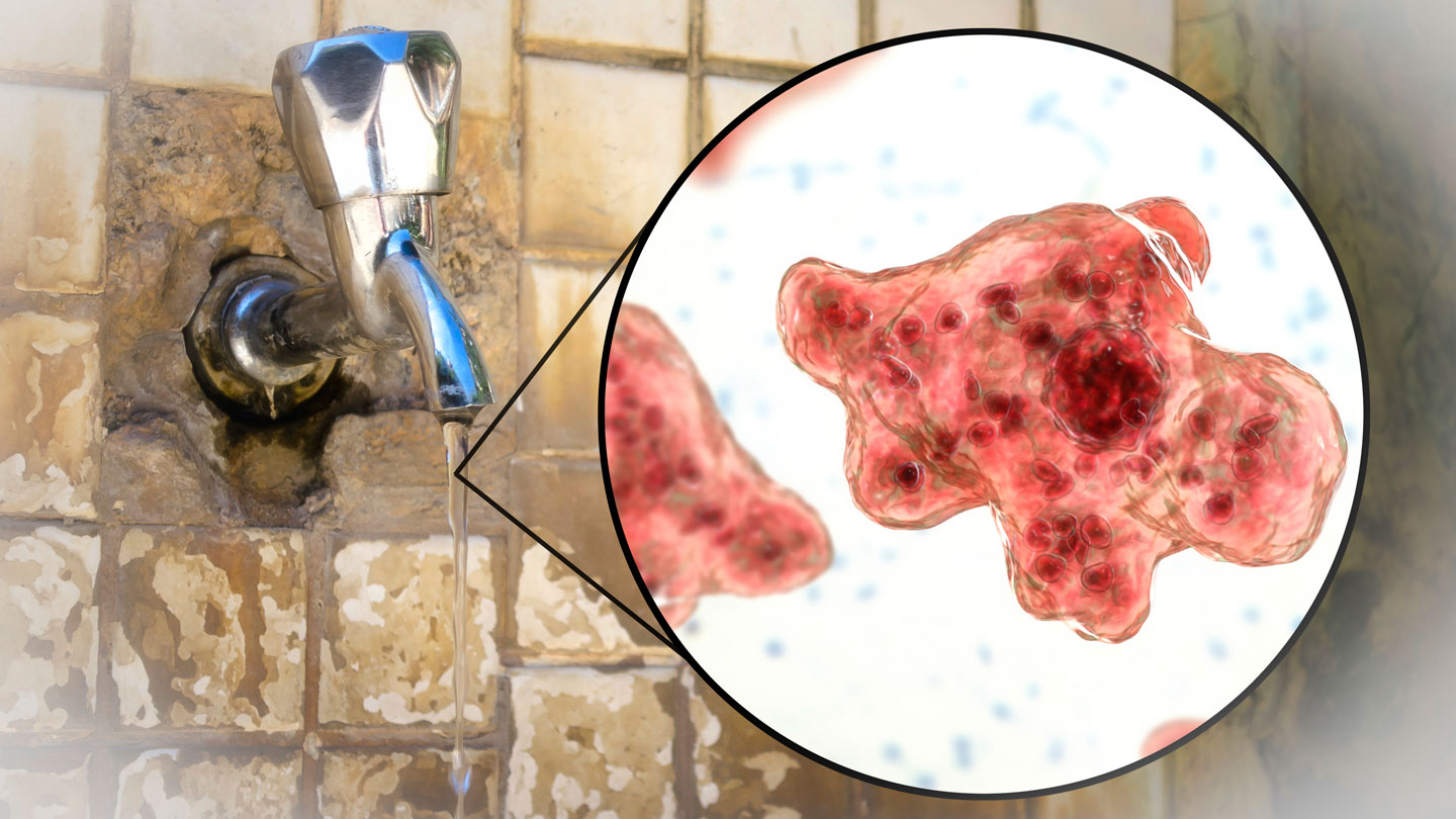No utilice agua del grifo sin esterilizar para enjuagarse los senos nasales.  Puede transportar amebas devoradoras de cerebros