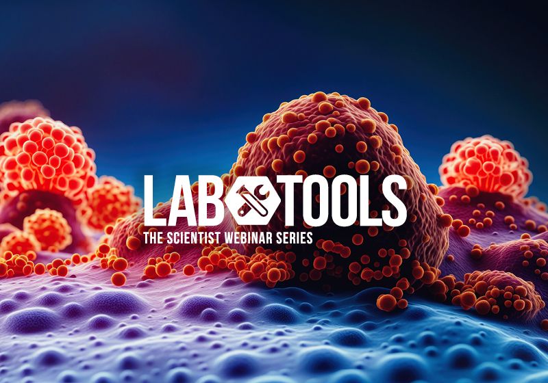 Optimers aporta precisión a la investigación y la terapéutica del cáncer