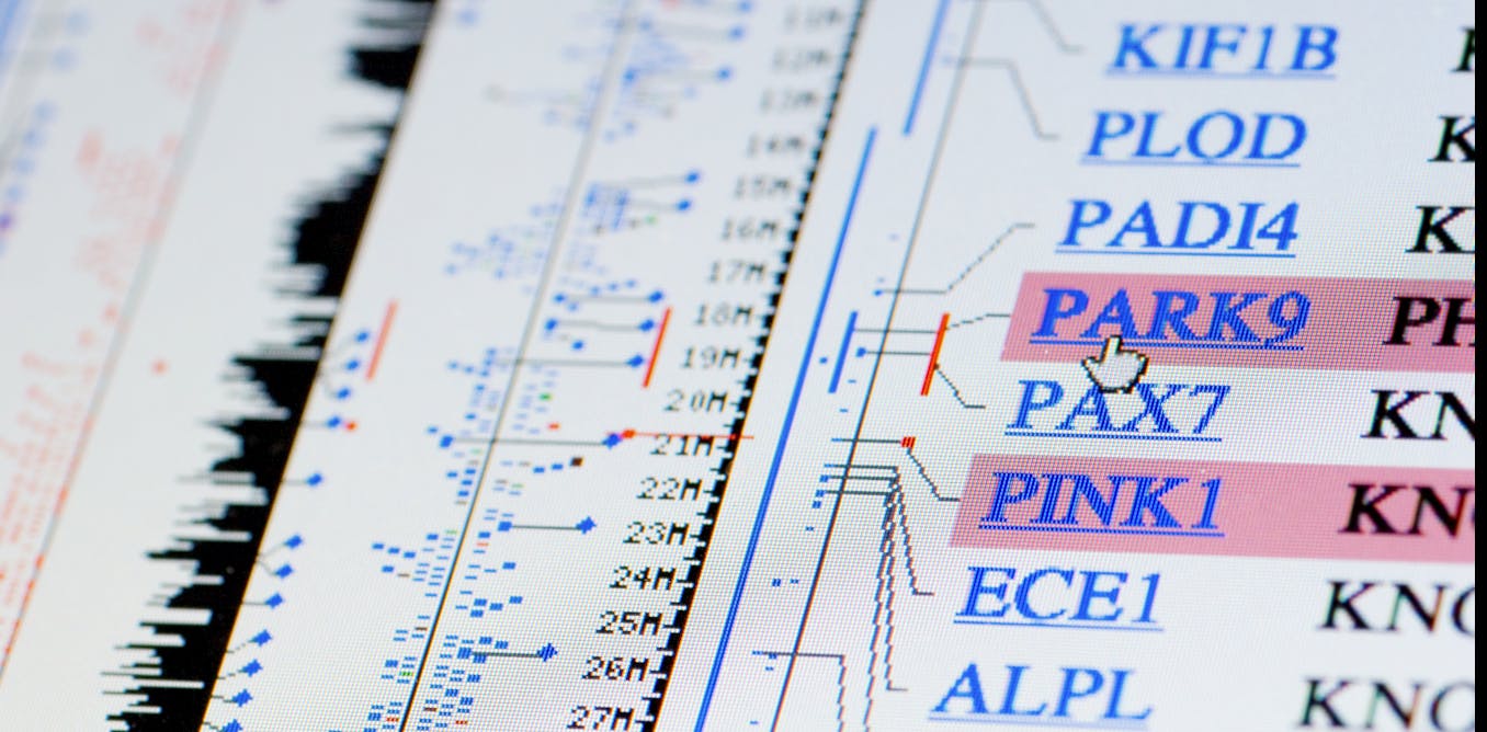 Variante que causa la enfermedad de Parkinson aclara por qué se desarrolla la enfermedad