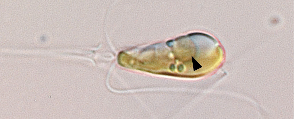 Un evento raro le dio a esta alga un orgánulo que atrapa y usa nitrógeno: ScienceAlert