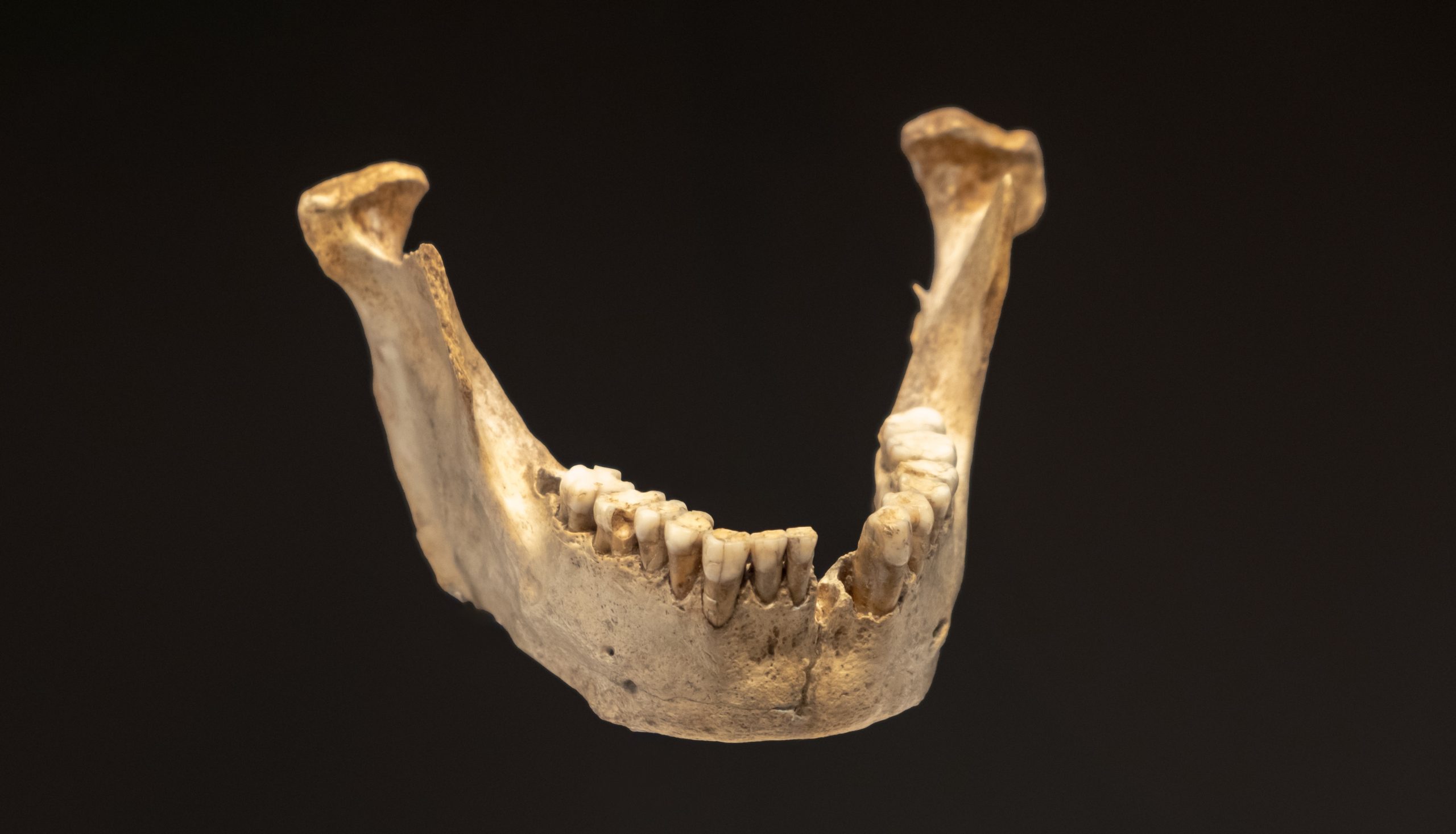 Los dientes antiguos de Neandertal y Paleolítico muestran signos de estrés infantil
