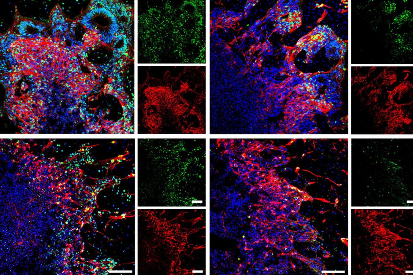 El tejido cerebral humano congelado ahora se puede revivir sin sufrir daños