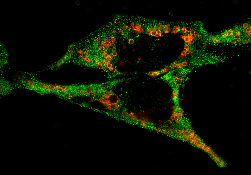 Las células cancerosas se propagan cuando dejan de reciclar residuos