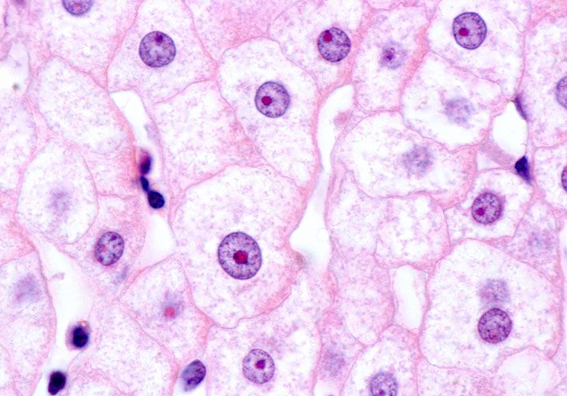 Las proteínas del hígado mantienen a las células T alejadas de los tumores