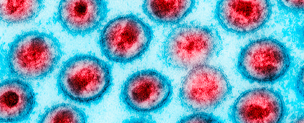 Un ensayo aleatorio encuentra que los hombres circuncidados tienen menos probabilidades de contraer el VIH: ScienceAlert