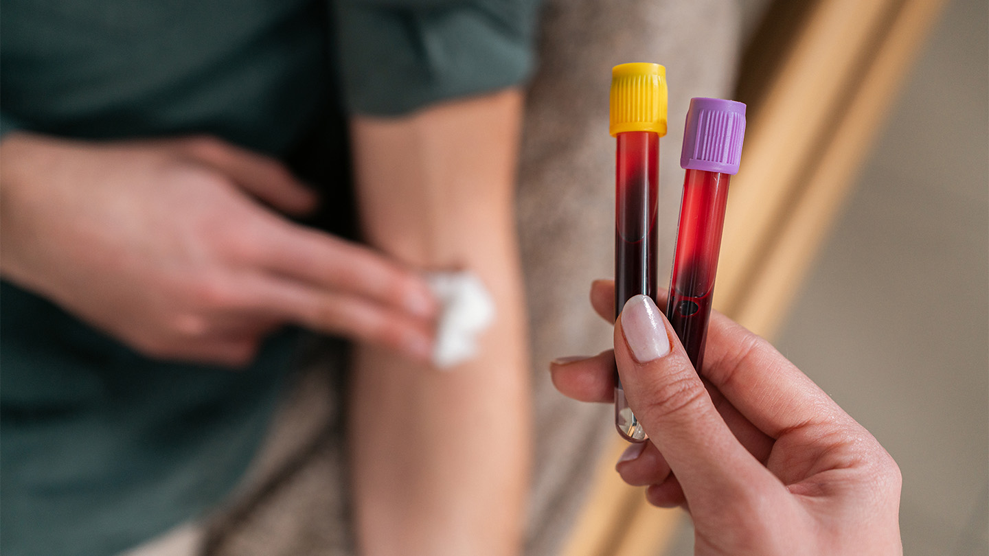 Las pruebas de sepsis tardan días y ponen en riesgo a los pacientes. Un nuevo método podría reducir el tiempo de espera