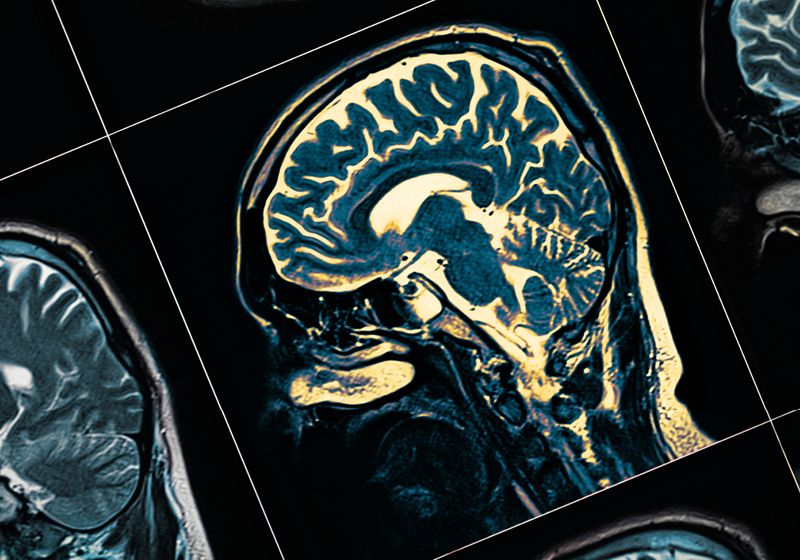 Los metabolitos de los microbios intestinales reducen los niveles de tau tóxica
