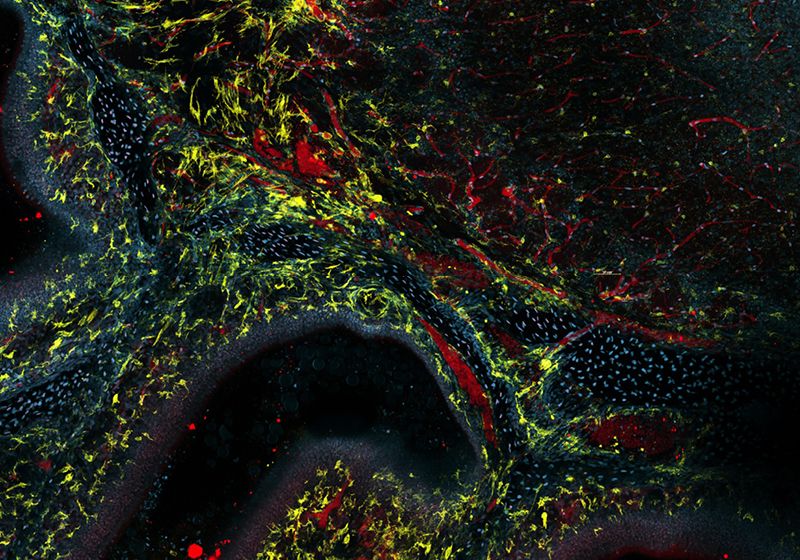 El estudio del cerebro durante las infecciones por hongos es ahora mucho más claro