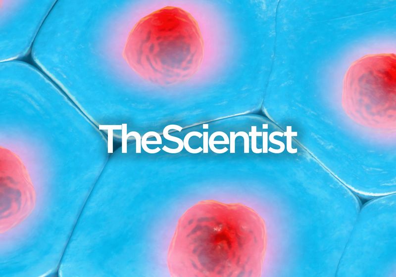 Explorando el microambiente tumoral con biología espacial