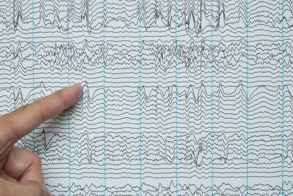 Desde el diagnóstico de trastornos cerebrales hasta la mejora cognitiva, 100 años de EEG han transformado la neurociencia