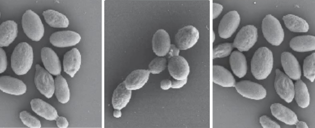 Los hongos patógenos están mutando peligrosamente a medida que el mundo se calienta: ScienceAlert
