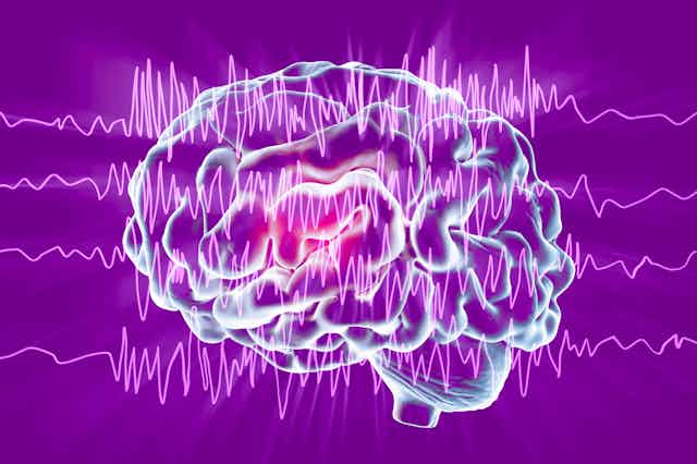 Cómo 100 años de EEG han transformado la neurociencia
