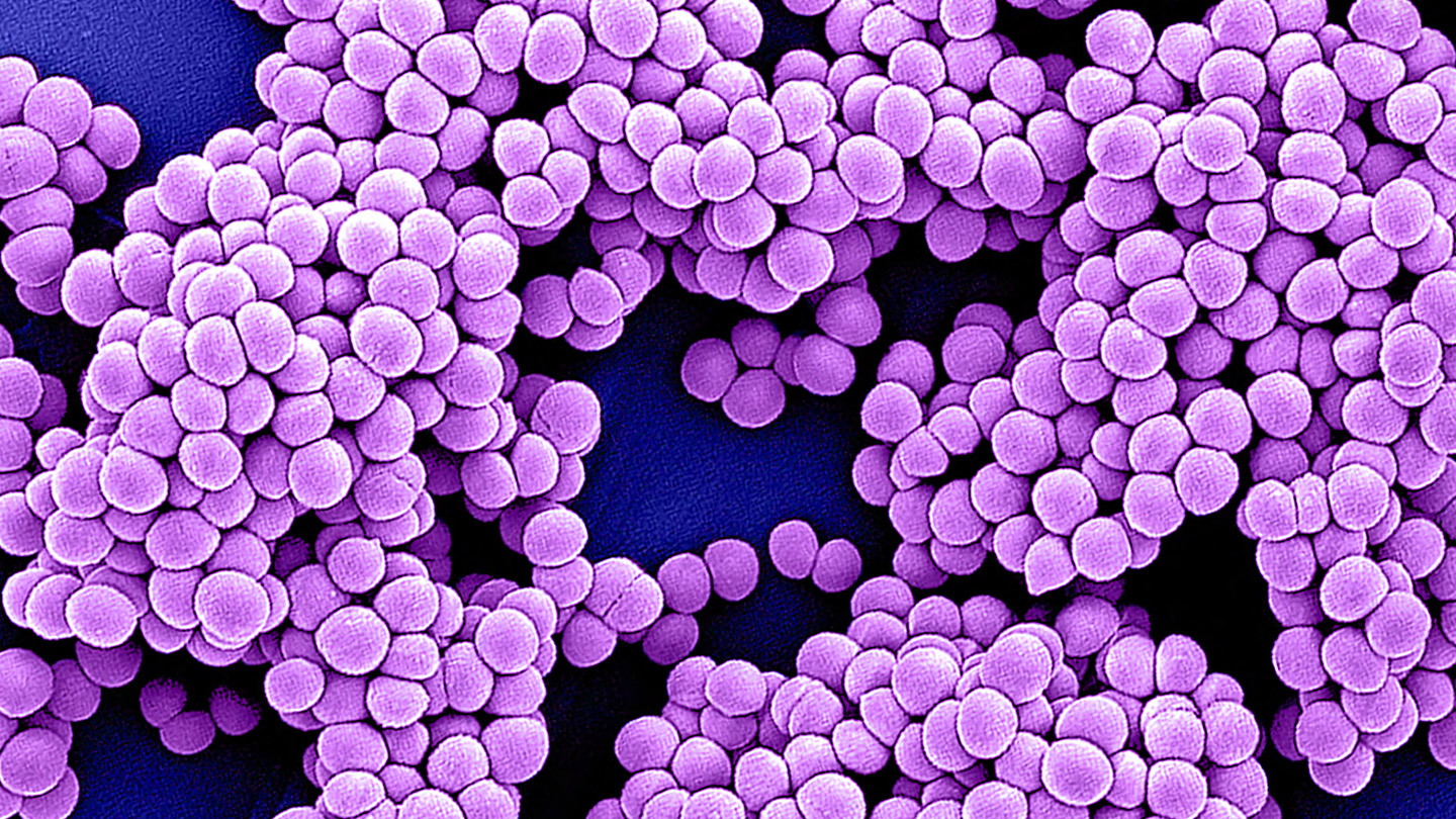Hace 50 años, las bacterias resistentes a los antibióticos se convirtieron en un problema fuera de los hospitales