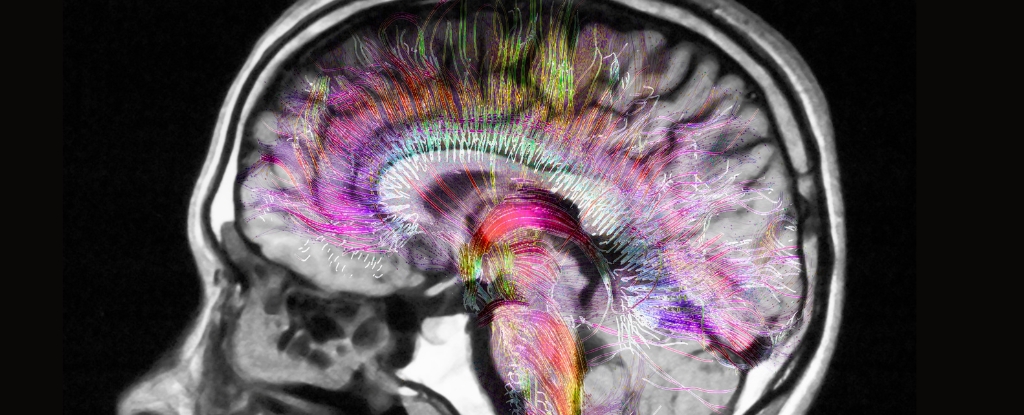 La FDA rechaza el MDMA para el trastorno de estrés postraumático. ¿Qué significa esto para los medicamentos psicodélicos futuros? : ScienceAlert