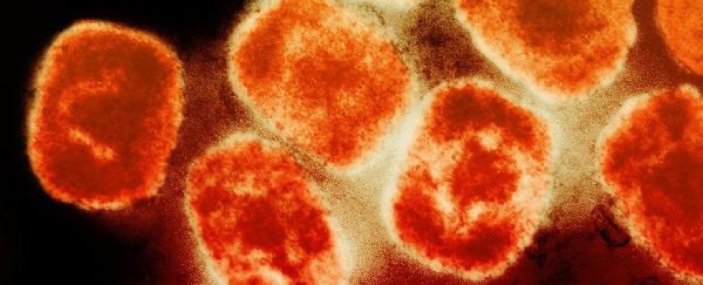 La OMS declara al virus Mpox como una emergencia sanitaria mundial ante la propagación de una nueva cepa del virus: ScienceAlert