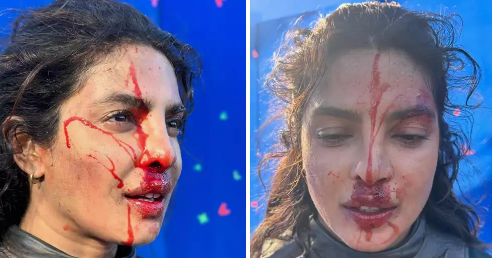 Priyanka Chopra Jonas está toda ensangrentada en estas fotos BTS de The Bluff