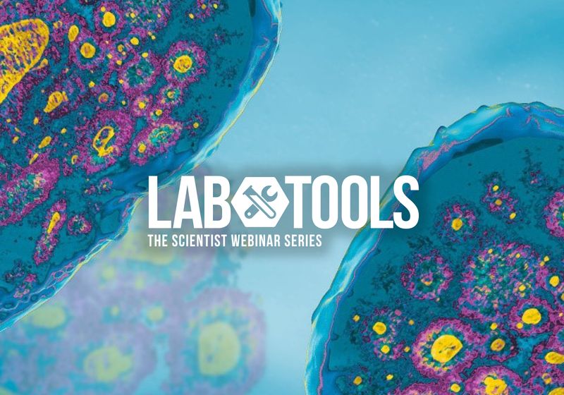 Modelos organoides e imágenes 3D para la investigación de la enfermedad de Parkinson