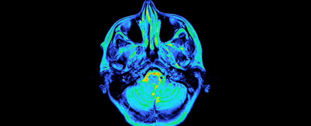 Revelan por primera vez cambios profundos en el cerebro durante el embarazo: ScienceAlert