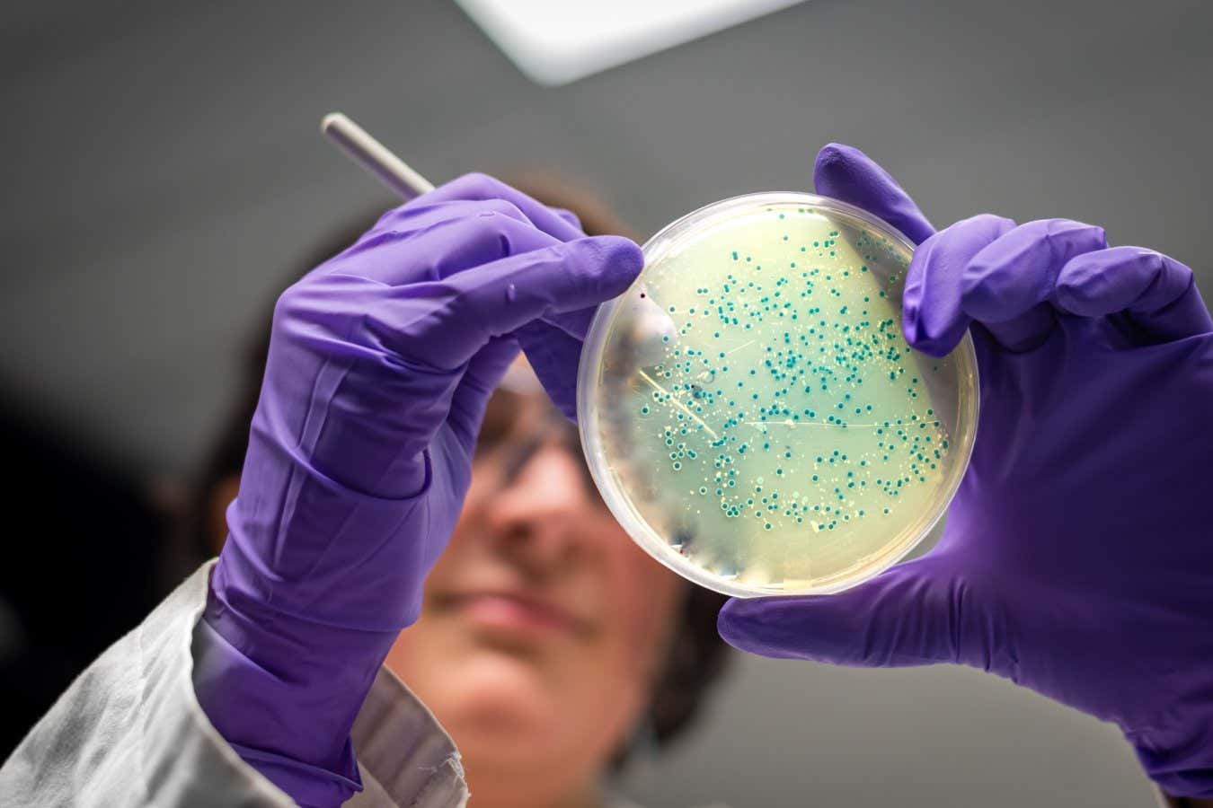 Se prevé que la resistencia a los antibióticos matará a 39 millones de personas en 2050