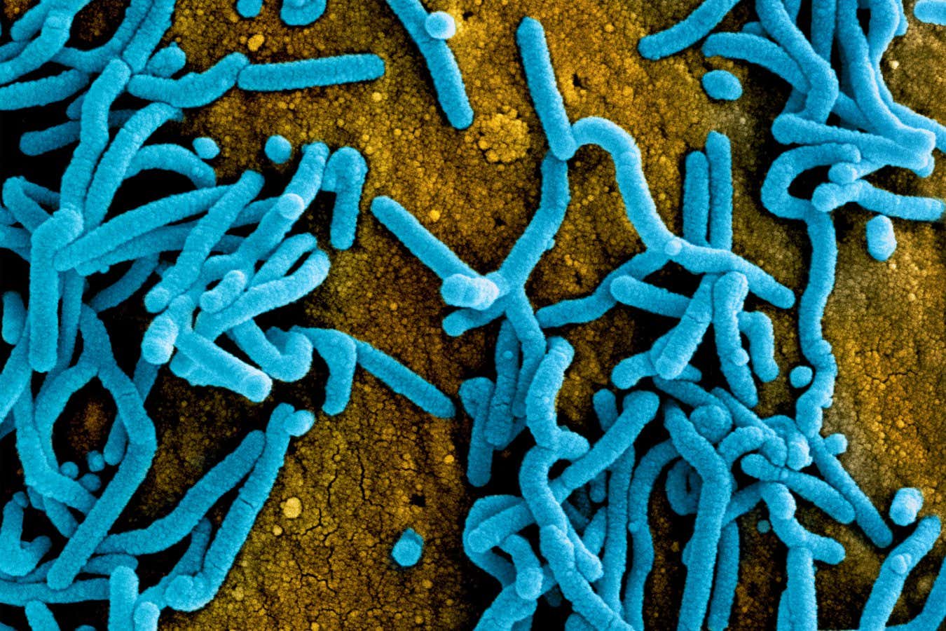 Virus de Marburgo: respuestas a todas sus preguntas sobre el brote de la enfermedad mortal