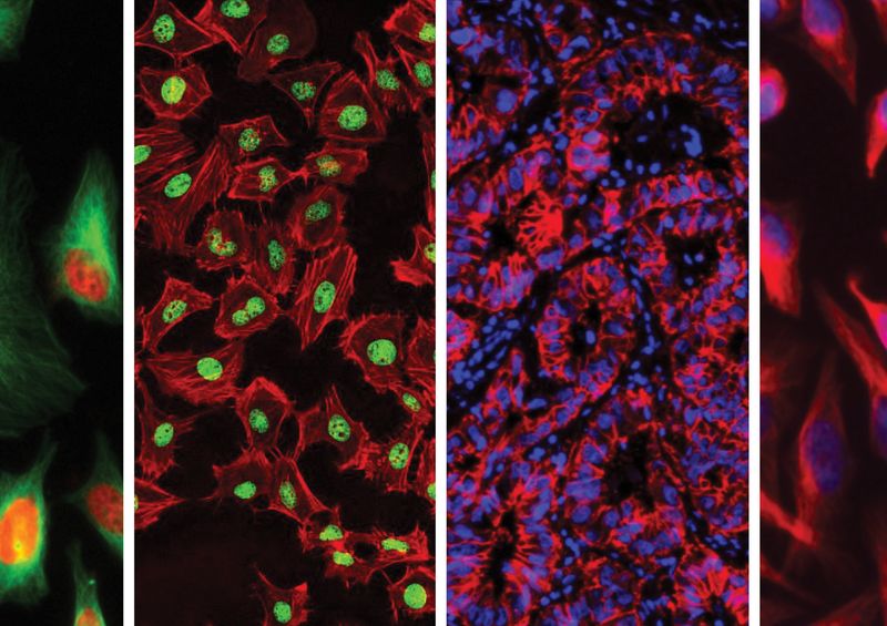 Ciencia iluminadora: el papel de los tintes fluorescentes en la biotecnología y la medicina