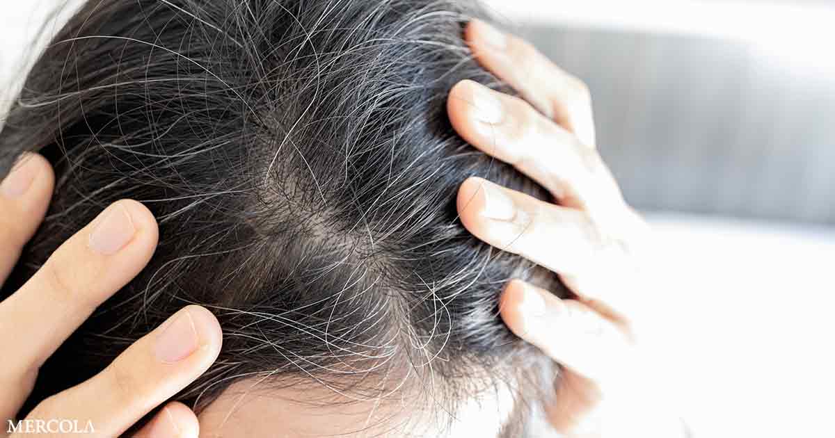 ¿Prematuramente gris? Probablemente esta sea la razón