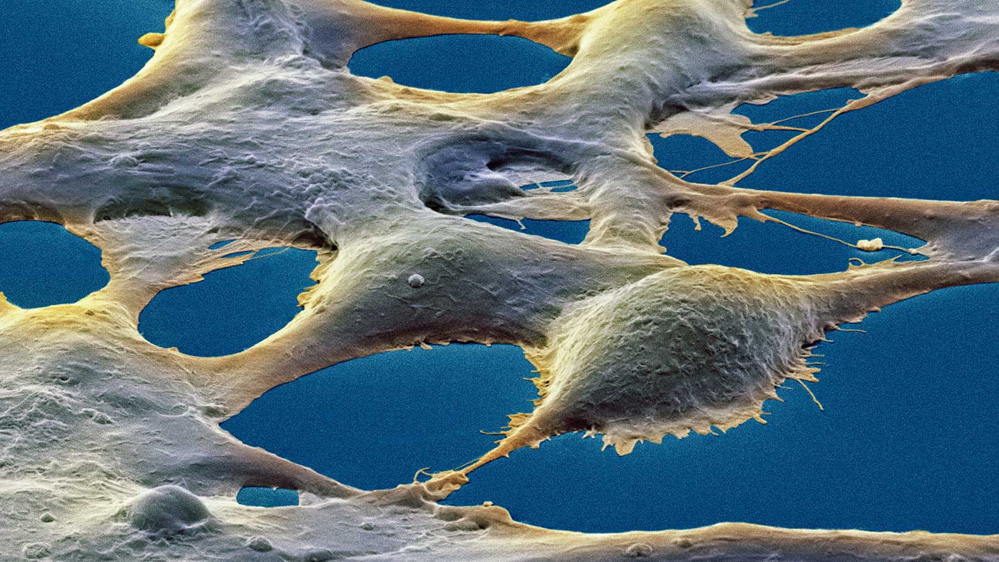 Al igual que las células cerebrales, las células renales pueden “recordar”