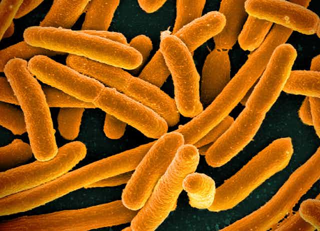 Los tratamientos futuros para las infecciones urinarias crónicas pueden agregar más bacterias a la vejiga