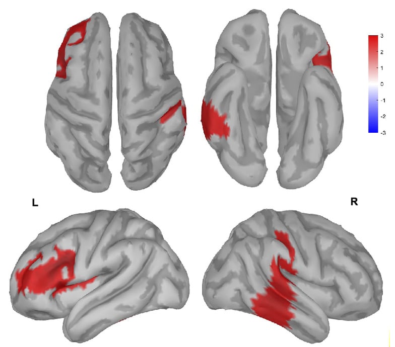 La fatiga mental hace que las áreas del cerebro se ‘queden dormidas’, lo que lleva a un comportamiento más agresivo