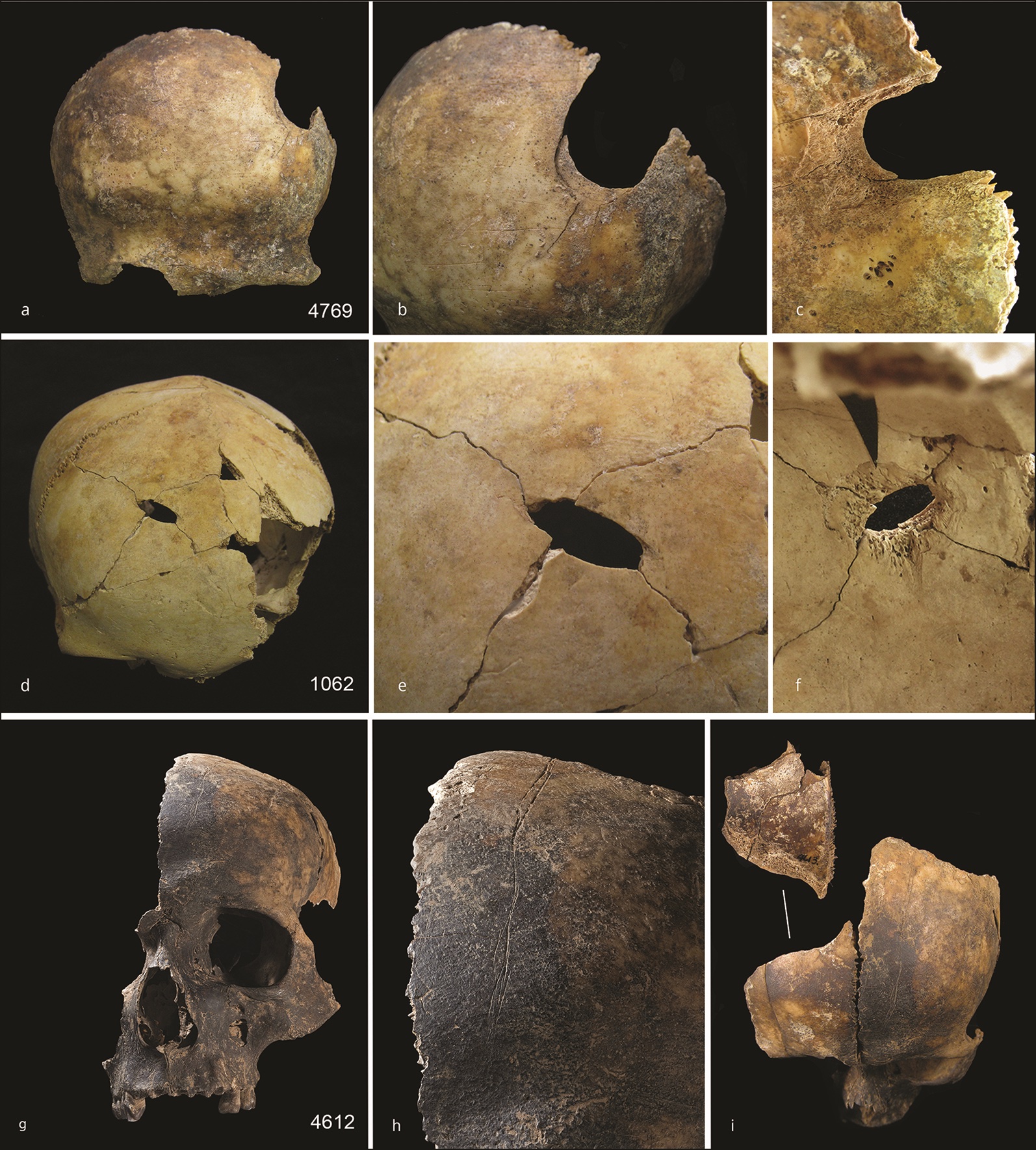 Huesos de la Edad de Bronce indican muerte violenta y posible canibalismo