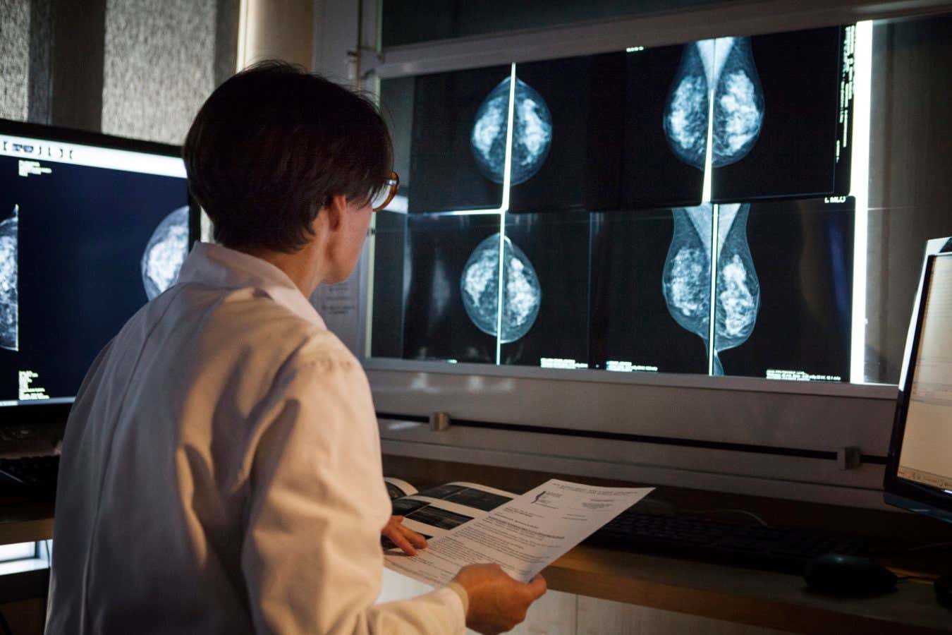 La IA ayuda a los radiólogos a detectar el cáncer de mama en pruebas del mundo real