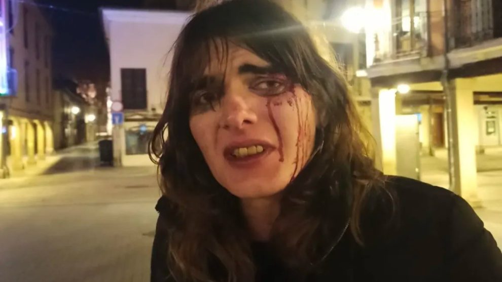 ‘Estoy tan asustado’: la mujer trans sufre un ataque horrible en las calles de Madrid