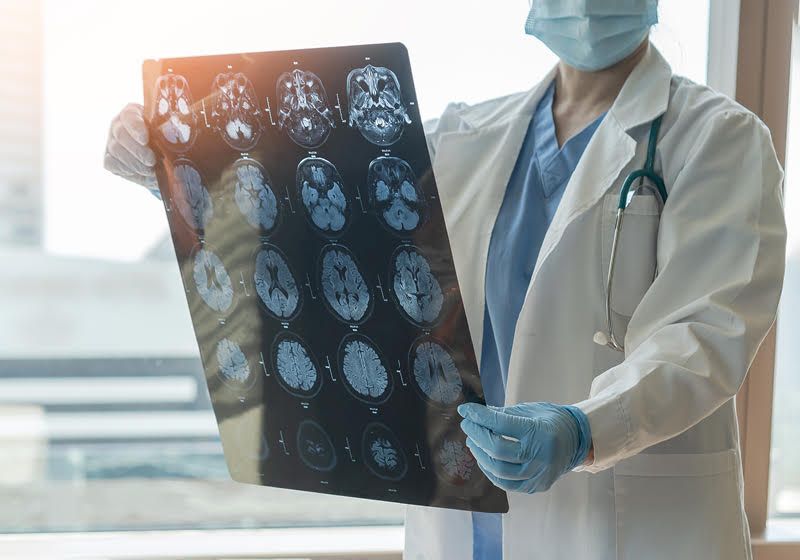 Comprender el lenguaje de la diafonía cerebro-músculo