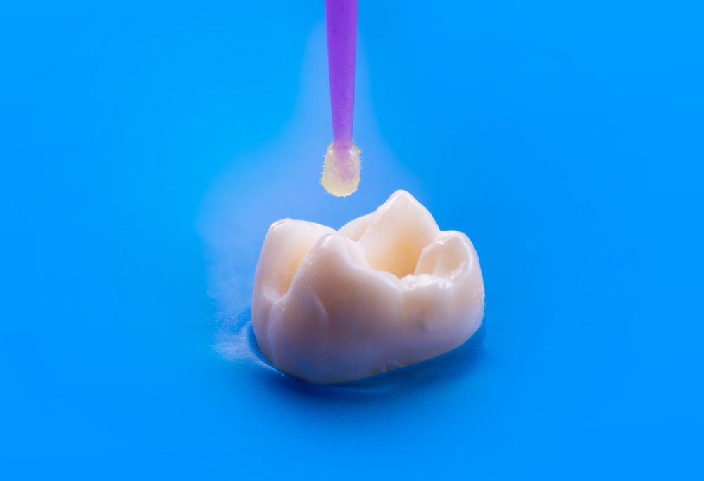 Revelar dientes está en el horizonte y puede representar el futuro de la odontología