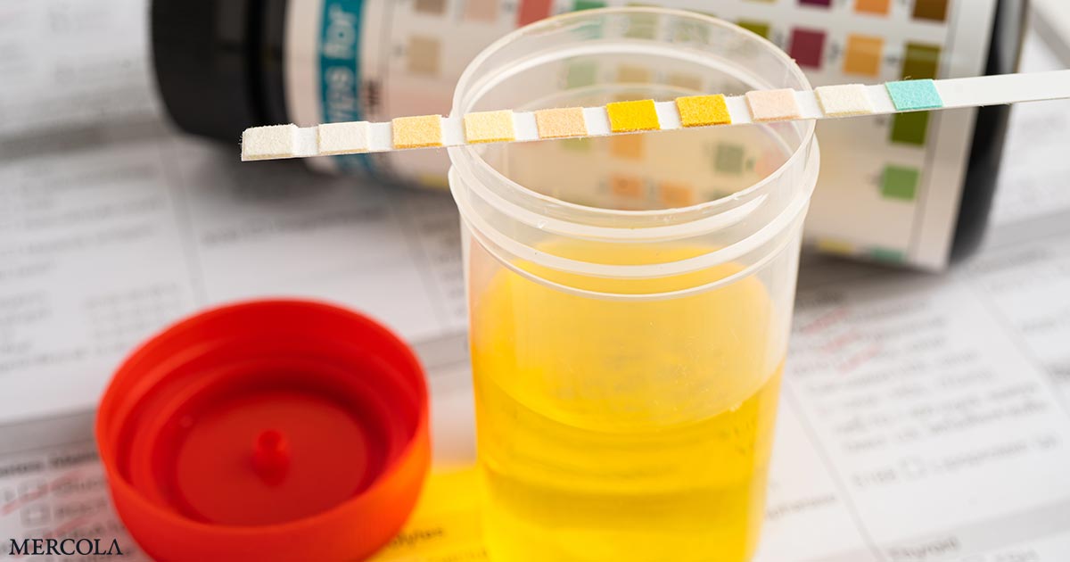 Lo que dice el olor de la orina sobre su salud