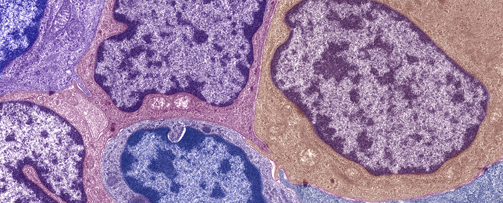 El cáncer de mama está aumentando en jóvenes mujeres estadounidenses, y no sabemos por qué: Sciencealert